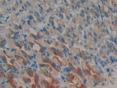 Polyclonal Antibody to Periplakin (PPL)