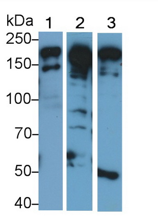 Polyclonal Antibody to Periplakin (PPL)