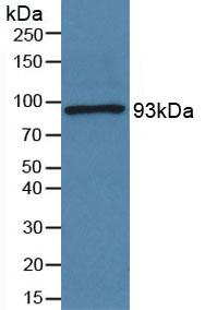 Polyclonal Antibody to Periostin (POSTN)