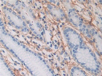 Polyclonal Antibody to Periostin (POSTN)