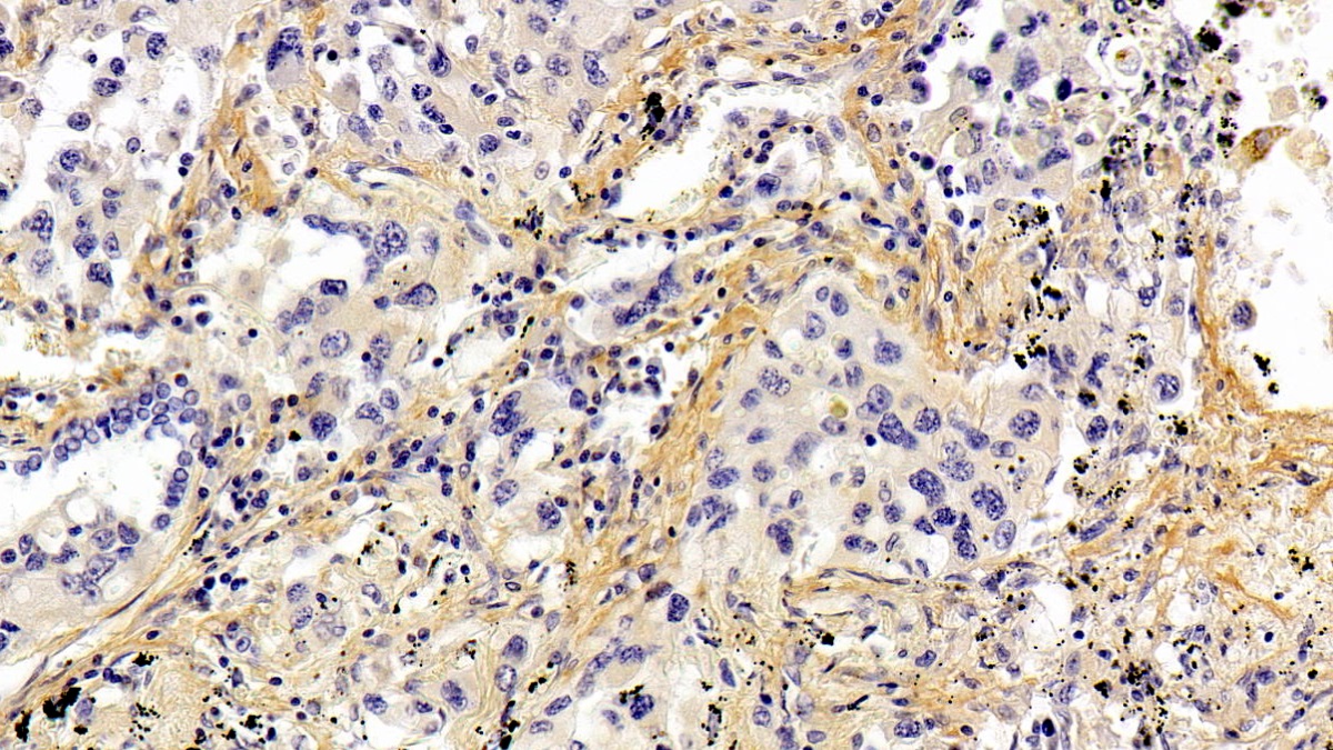 Polyclonal Antibody to Periostin (POSTN)