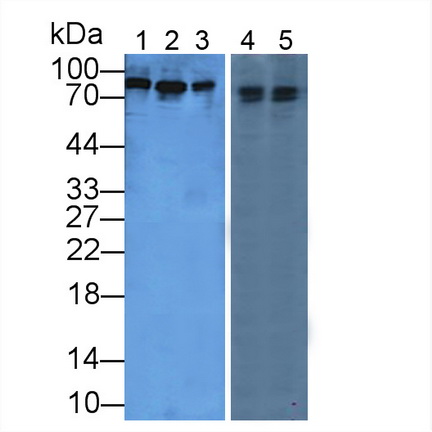 Polyclonal Antibody to Periostin (POSTN)