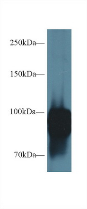 Polyclonal Antibody to Periostin (POSTN)