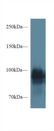 Polyclonal Antibody to Periostin (POSTN)