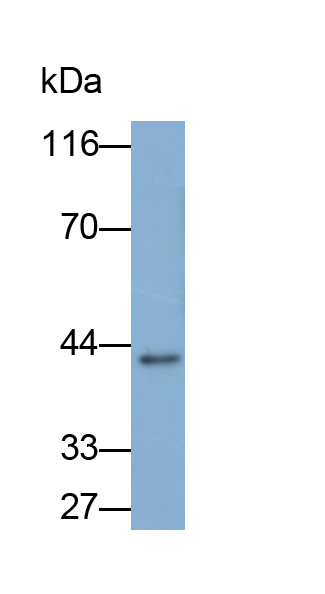 Polyclonal Antibody to Paraneoplastic Antigen MA2 (PNMA2)