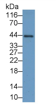 Polyclonal Antibody to Paraneoplastic Antigen MA2 (PNMA2)