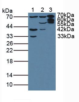 Polyclonal Antibody to Plastin 3 (PLS3)