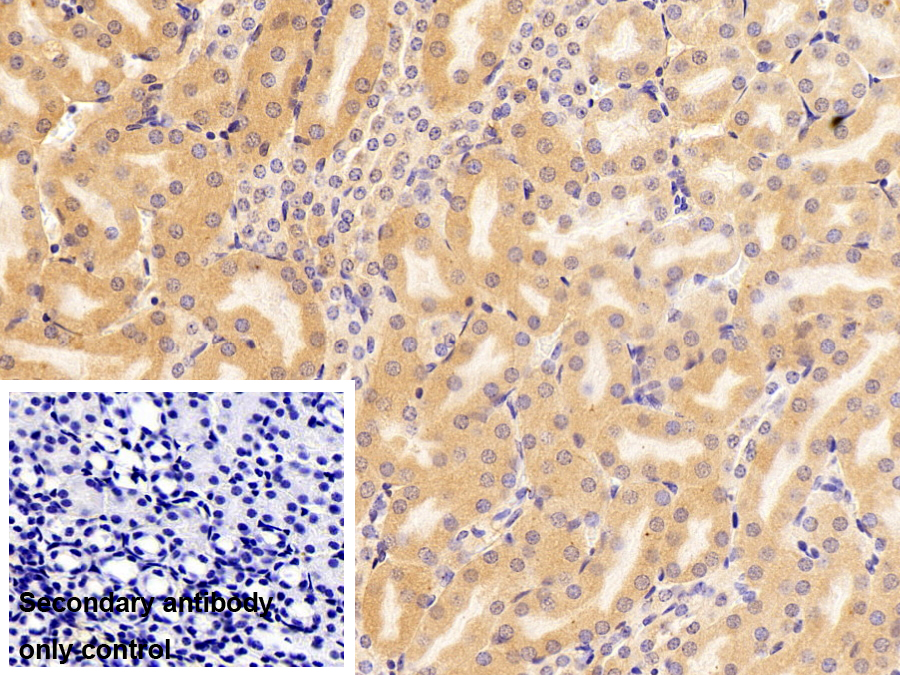 Polyclonal Antibody to Plastin 1 (PLS1)