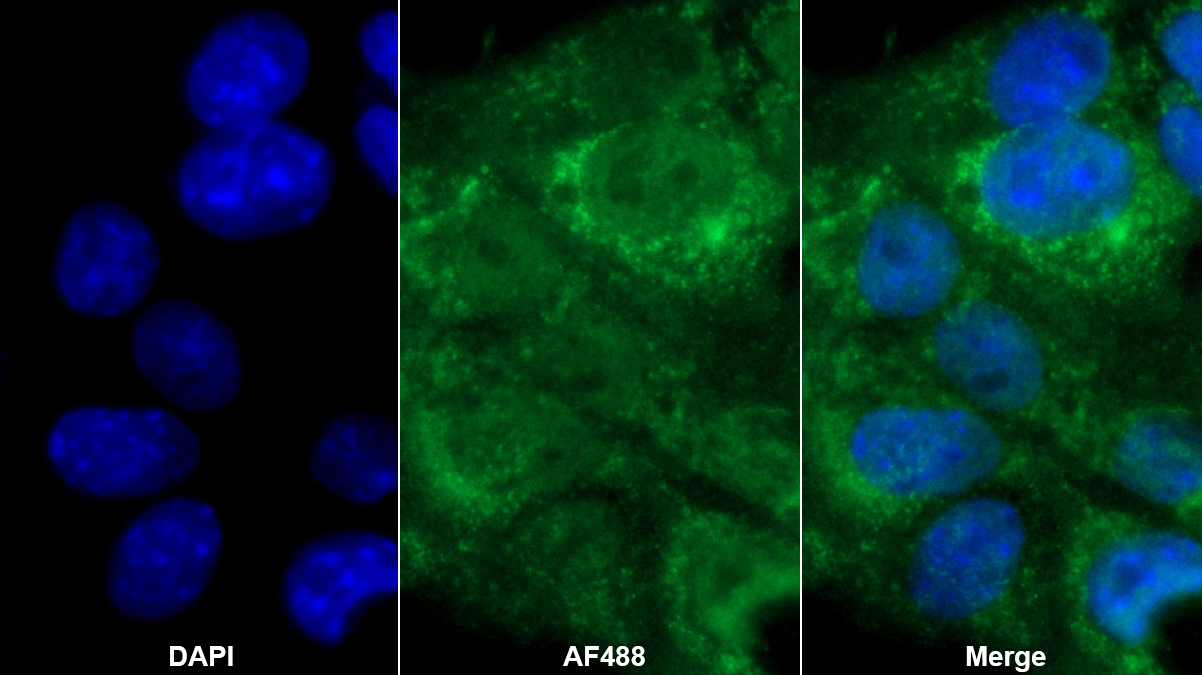 Polyclonal Antibody to Pyruvate Dehydrogenase Complex Component X (PDHX)