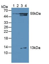 Polyclonal Antibody to 3-Oxoacid Coenzyme A Transferase 1 (OXCT1)