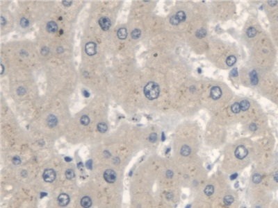 Polyclonal Antibody to 3-Oxoacid Coenzyme A Transferase 1 (OXCT1)