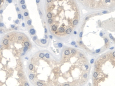 Polyclonal Antibody to 3-Oxoacid Coenzyme A Transferase 1 (OXCT1)