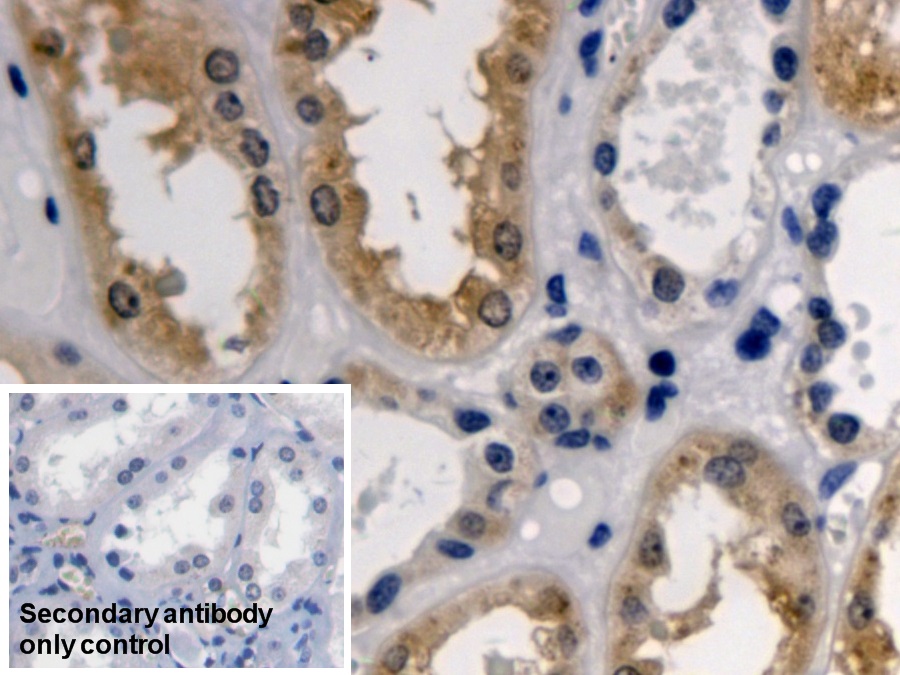 Polyclonal Antibody to 3-Oxoacid Coenzyme A Transferase 1 (OXCT1)