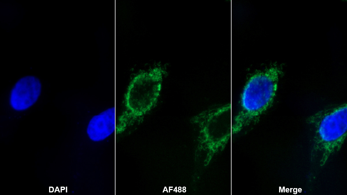 Polyclonal Antibody to 3-Oxoacid Coenzyme A Transferase 1 (OXCT1)