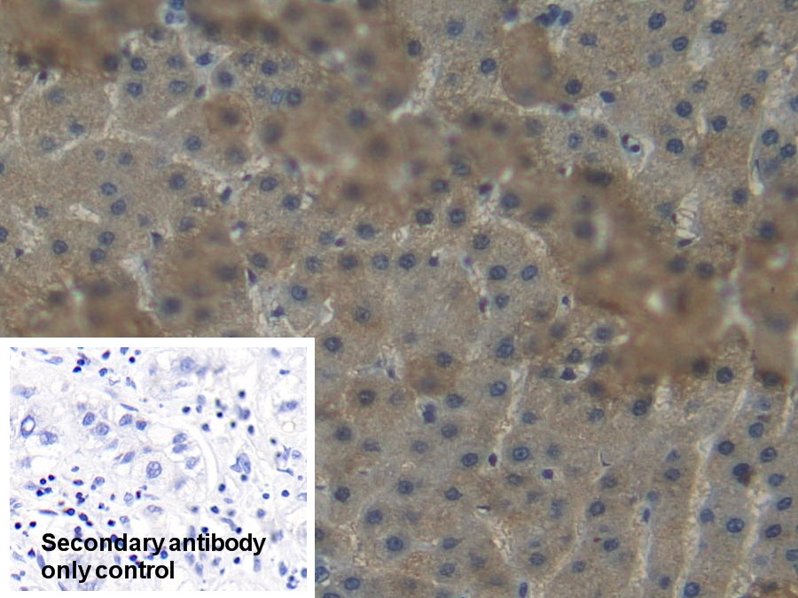 Polyclonal Antibody to Nicotinamide-N-Methyltransferase (NNMT)