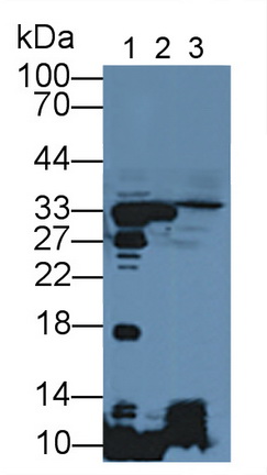 Polyclonal Antibody to Nicotinamide-N-Methyltransferase (NNMT)