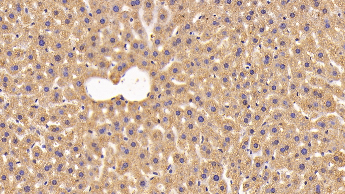 Polyclonal Antibody to Nicotinamide-N-Methyltransferase (NNMT)