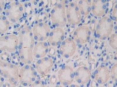 Polyclonal Antibody to Nexilin (NEXN)