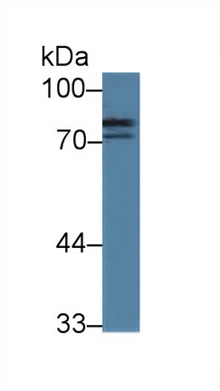 Polyclonal Antibody to Nexilin (NEXN)