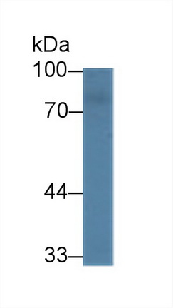 Polyclonal Antibody to Nexilin (NEXN)