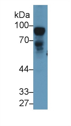 Polyclonal Antibody to Nexilin (NEXN)
