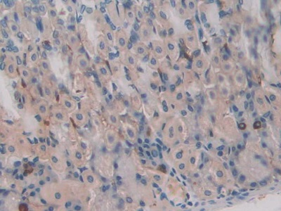 Polyclonal Antibody to N-Acetylgalactosaminidase Alpha (NAGa)