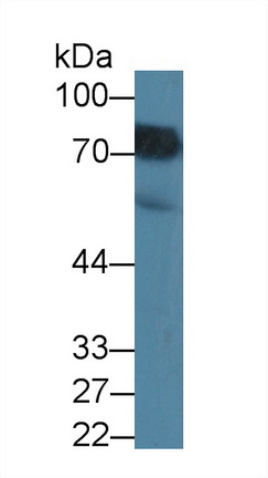 Polyclonal Antibody to Methylenetetrahydrofolate Reductase (MTHFR)