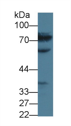 Polyclonal Antibody to Methylenetetrahydrofolate Reductase (MTHFR)