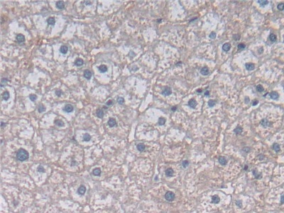 Polyclonal Antibody to Methylenetetrahydrofolate Reductase (MTHFR)