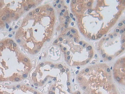 Polyclonal Antibody to Methylenetetrahydrofolate Reductase (MTHFR)