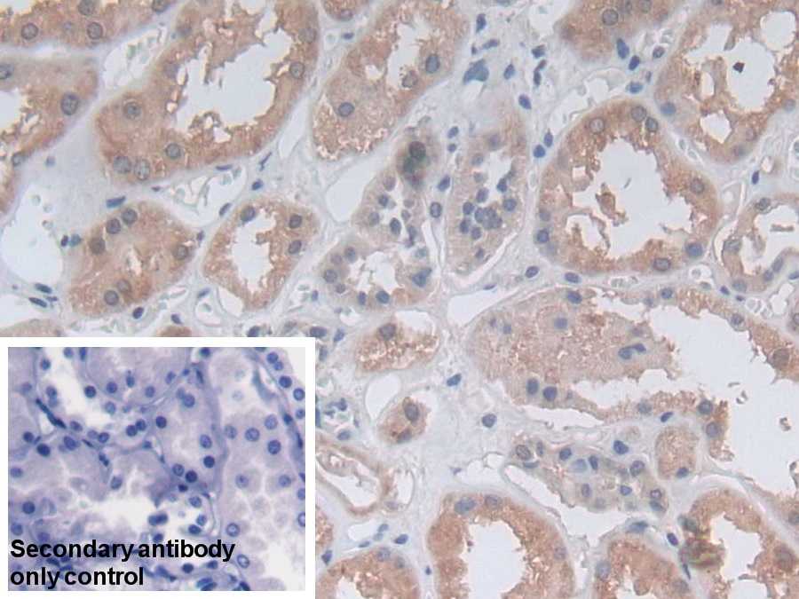 Polyclonal Antibody to Methylenetetrahydrofolate Reductase (MTHFR)