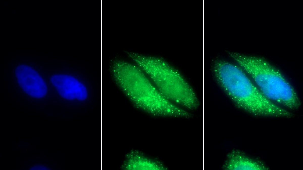 Polyclonal Antibody to Malate Dehydrogenase 2 (MDH2)