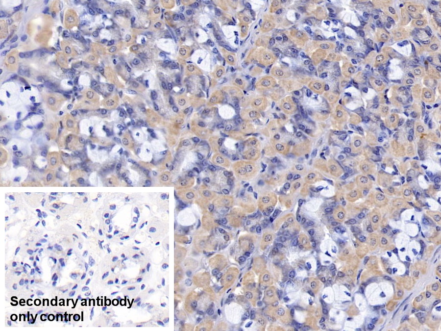 Polyclonal Antibody to Malate Dehydrogenase 2 (MDH2)