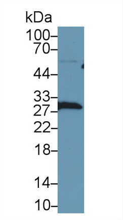 Polyclonal Antibody to Latexin (LXN)