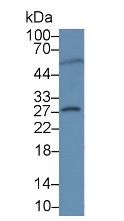 Polyclonal Antibody to Latexin (LXN)