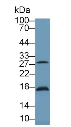 Polyclonal Antibody to Latexin (LXN)