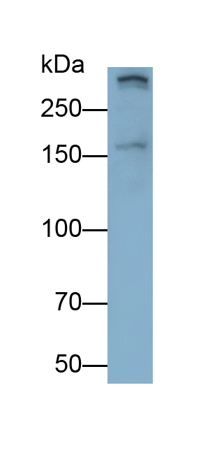Polyclonal Antibody to Leucine Rich Repeat Kinase 2 (LRRK2)