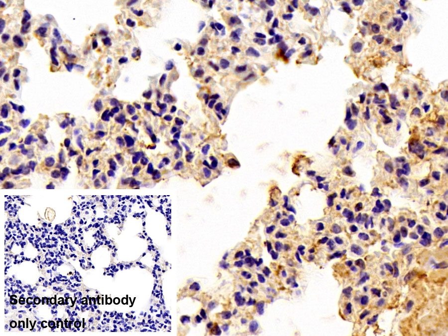 Polyclonal Antibody to Leucine Rich Repeat Kinase 2 (LRRK2)