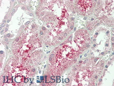 Polyclonal Antibody to Klotho Beta (KLb)