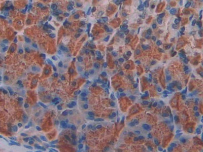 Polyclonal Antibody to Klotho Beta (KLb)