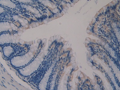 Polyclonal Antibody to Klotho (KL)