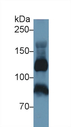 Polyclonal Antibody to Inter Alpha-Globulin Inhibitor H4 (ITIH4)