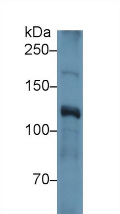 Polyclonal Antibody to Inter Alpha-Globulin Inhibitor H4 (ITIH4)