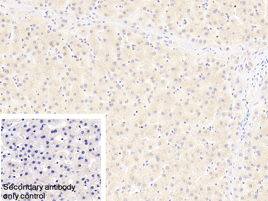 Polyclonal Antibody to Inter Alpha-Globulin Inhibitor H4 (ITIH4)