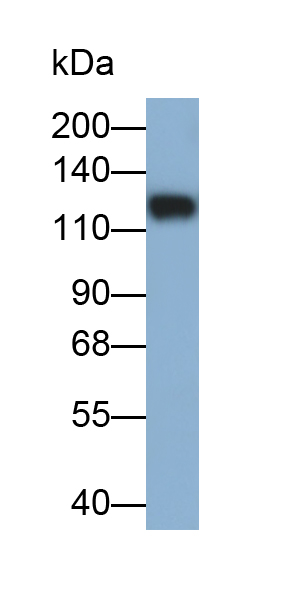 Polyclonal Antibody to Inter Alpha-Globulin Inhibitor H4 (ITIH4)