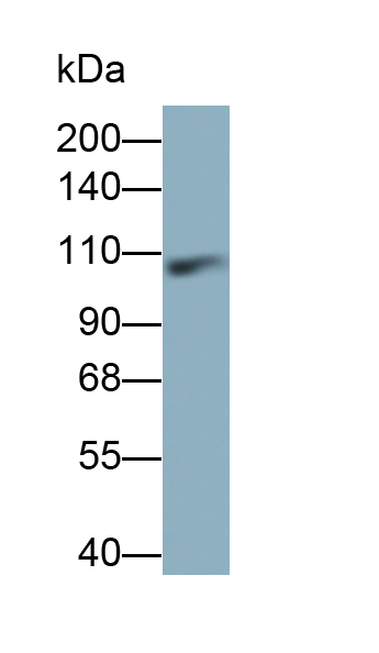 Polyclonal Antibody to Inter Alpha-Globulin Inhibitor H4 (ITIH4)