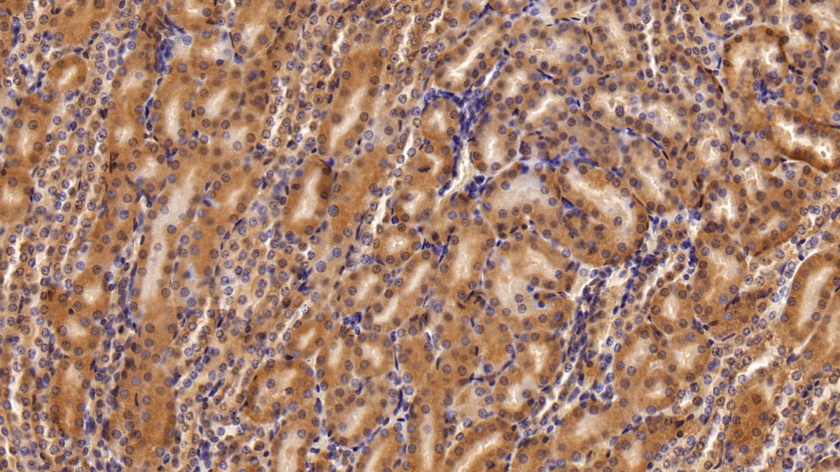 Polyclonal Antibody to Inter Alpha-Globulin Inhibitor H4 (ITIH4)