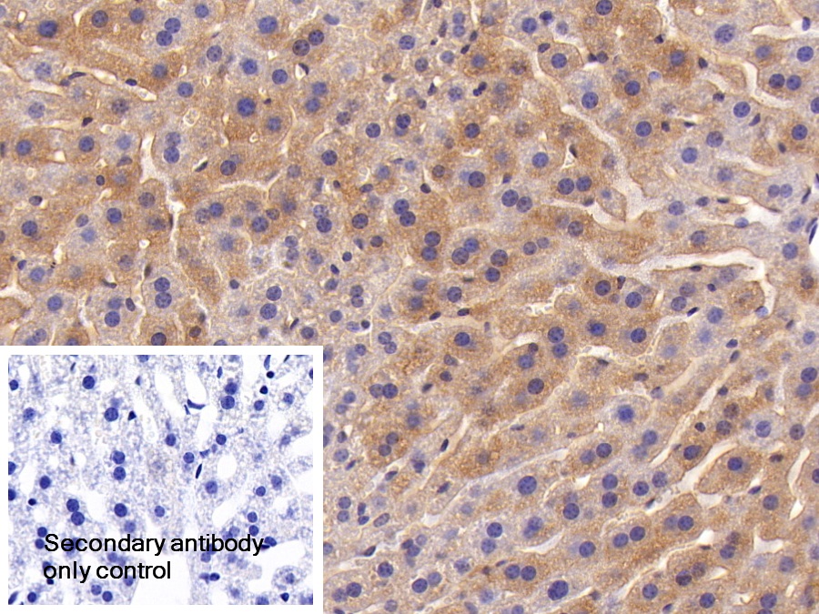 Polyclonal Antibody to Inter Alpha-Globulin Inhibitor H4 (ITIH4)