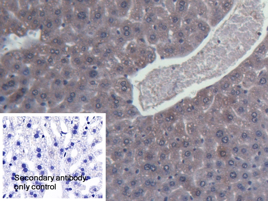 Polyclonal Antibody to Inter Alpha-Globulin Inhibitor H4 (ITIH4)