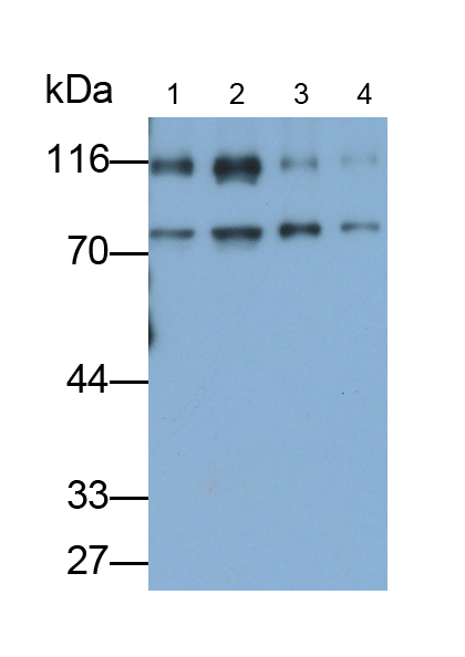 Polyclonal Antibody to Inter Alpha-Globulin Inhibitor H1 (ITIH1)
